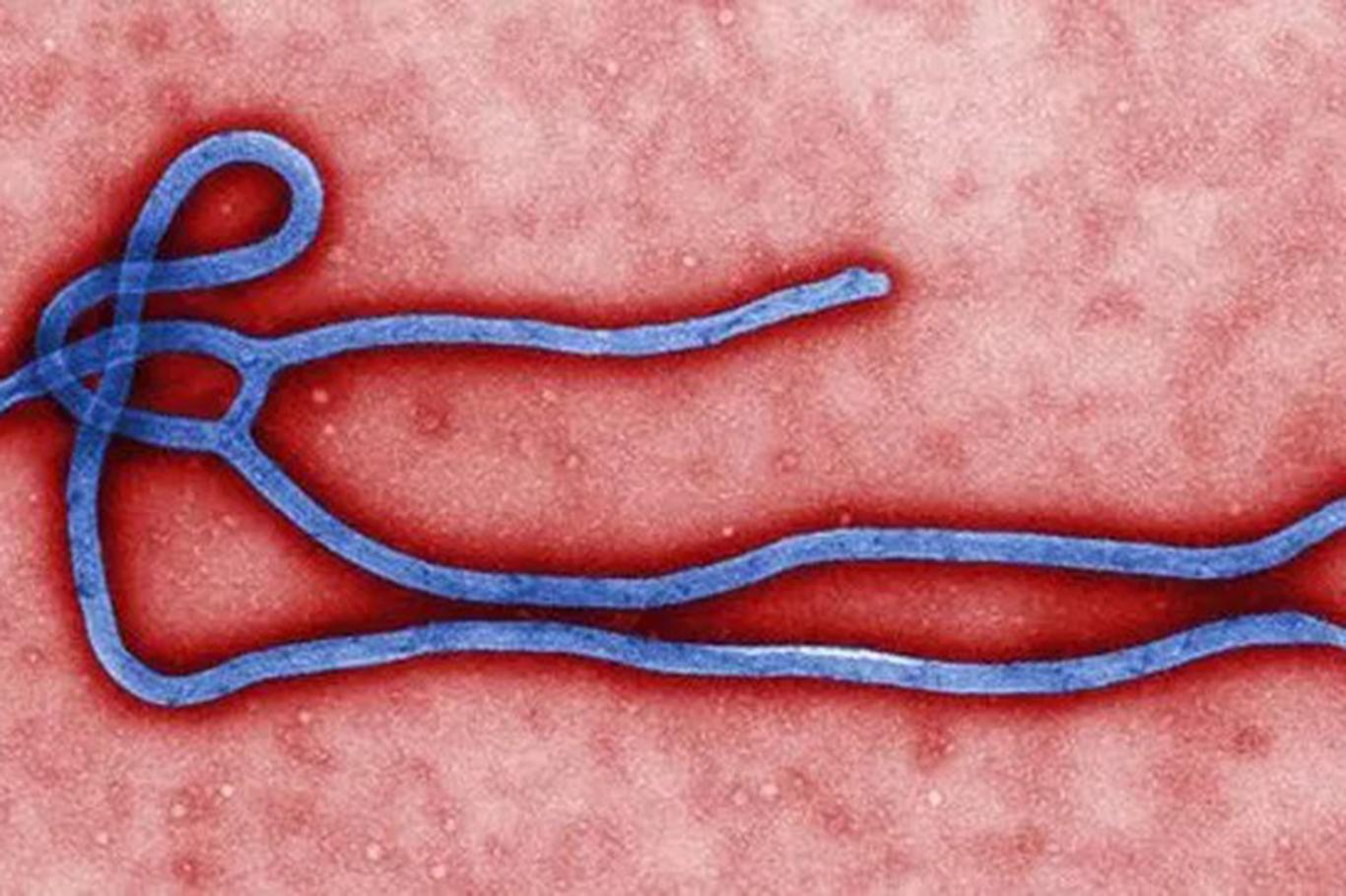 Sağlık Bakanlığından "Ebola virüsü" rehberi Sağlık Bakanlığından "Ebola virüsü" rehberi